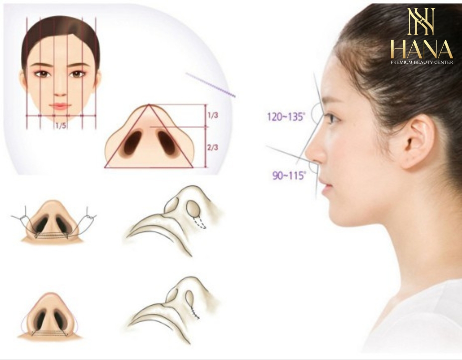 Thu Gọn Cánh Mũi