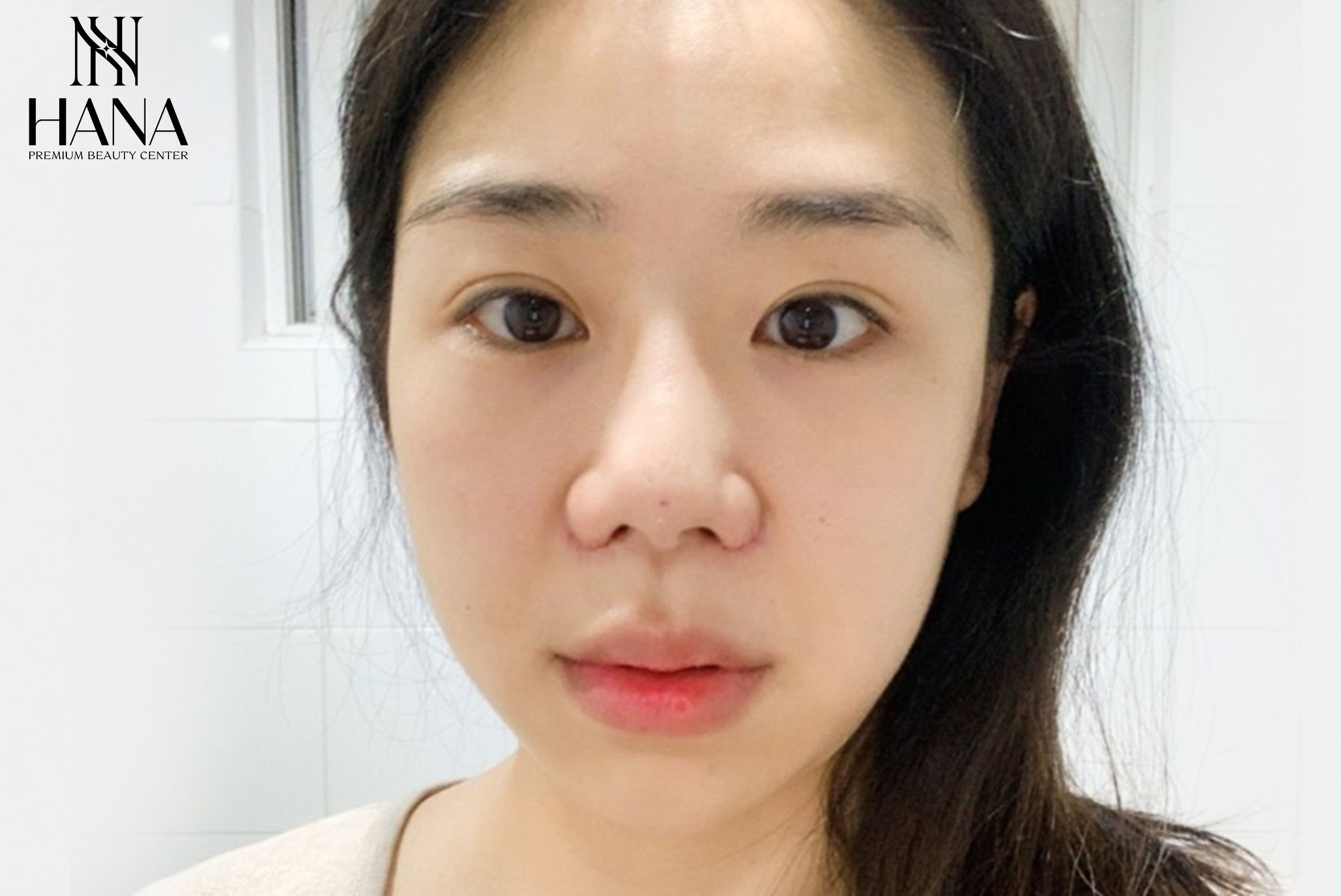 Thu Nhỏ Đầu Mũi