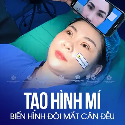 Cắt mí mắt