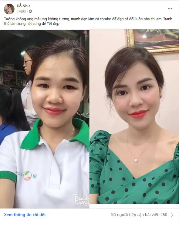 Cắt mí mắt