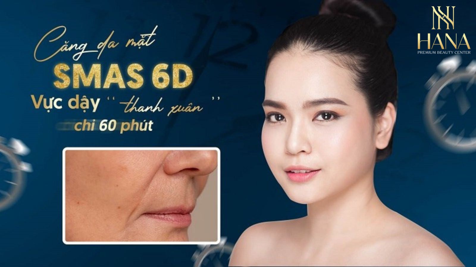 Căng da mặt SMAS PRO: Công nghệ diệu kỳ, giữ mãi nét xuân
