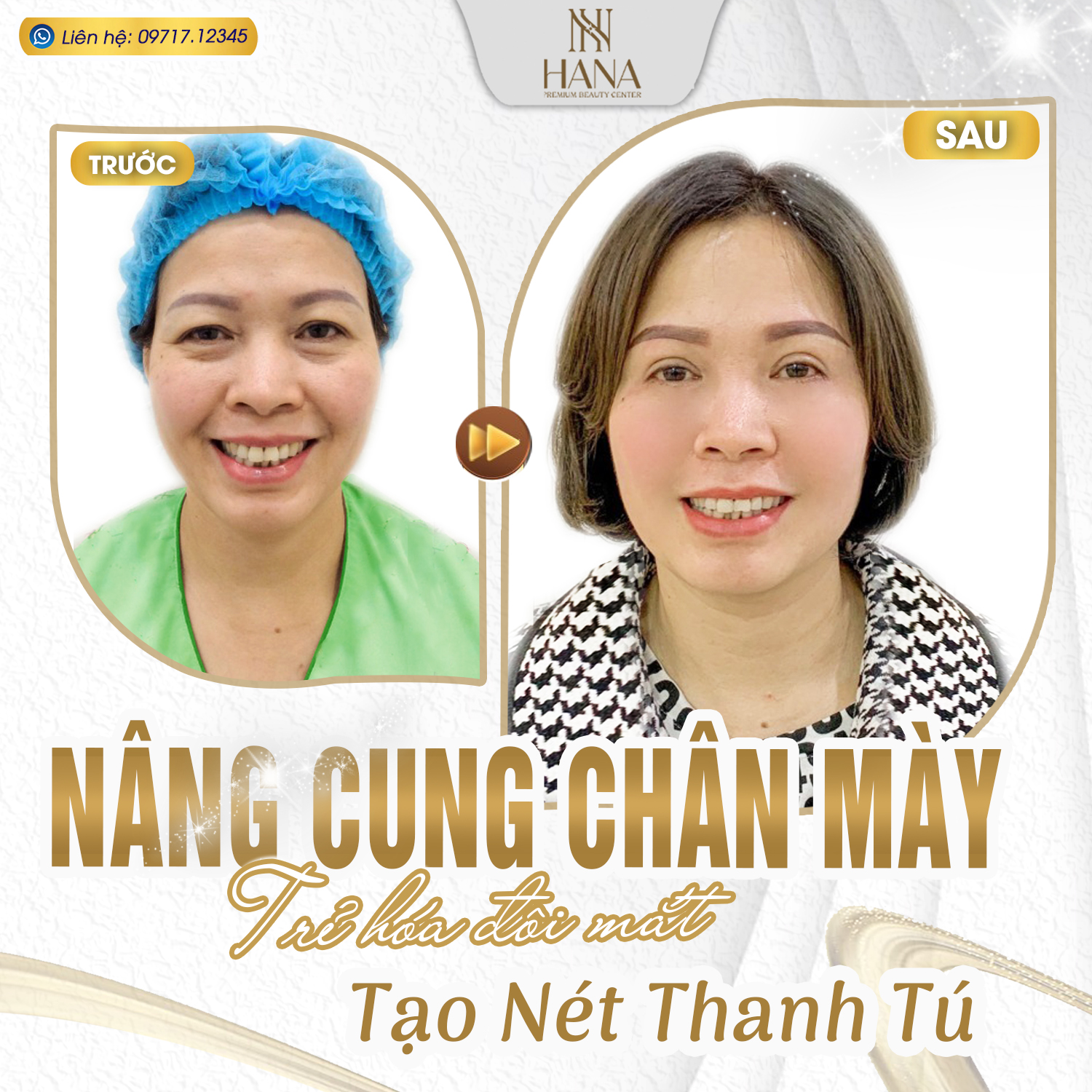 Treo cung mày