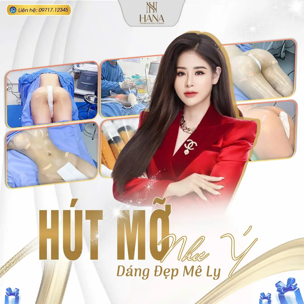 Hút mỡ