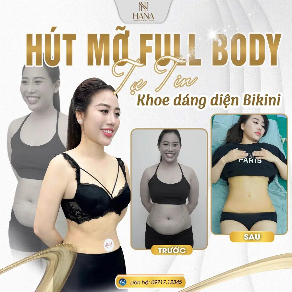 Hút mỡ